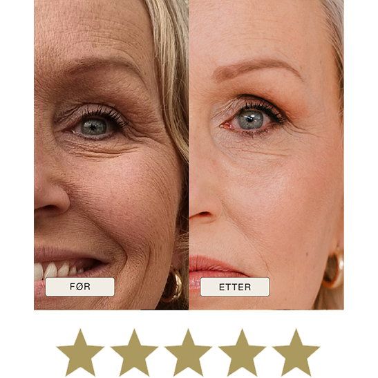 i_NaturalMagic_Before_After_Alma_FI_2025_withstars