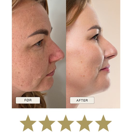 i_NaturalMagic_Before_After_Beata_FI_2025_withstars