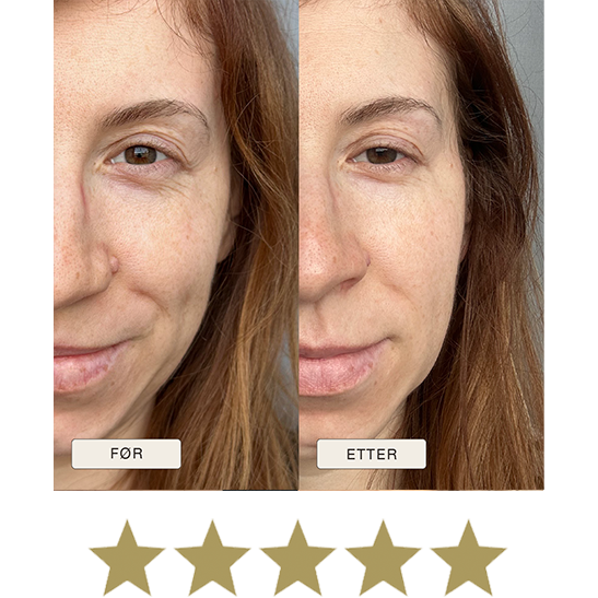 i_NaturalMagic_Before_After_Patrysjia_FI_2025_withstars