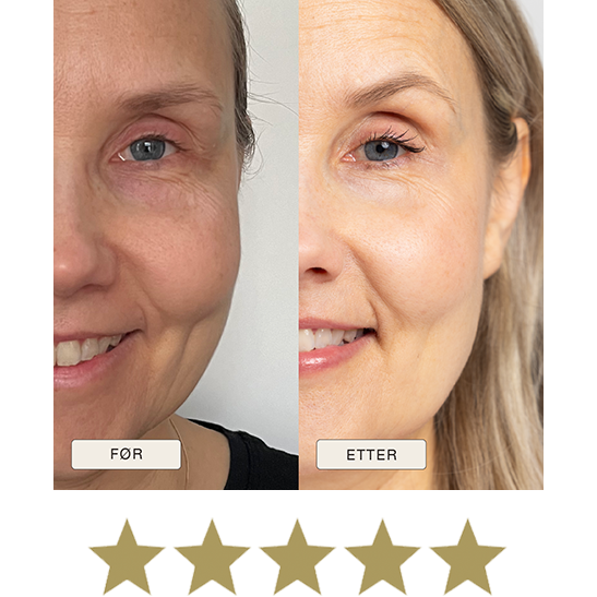 i_NaturalMagic_Before_After_Teija_FI_2025_withstars