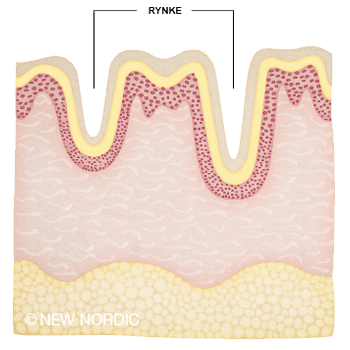 ill_skincare_collagenfiller_dk_skin_before_after_miefrey