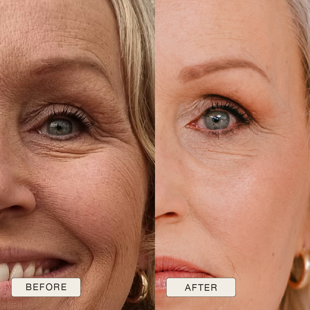i_NaturalMagic_Before_After_Alma_NL_2025