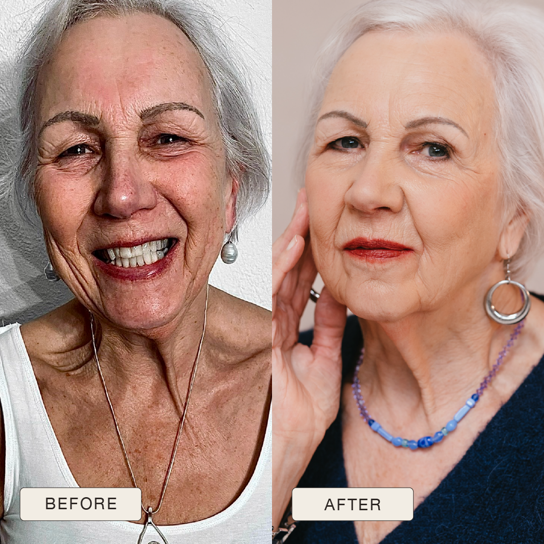 i_NaturalMagic_Before_After_Antoinette_2025-13