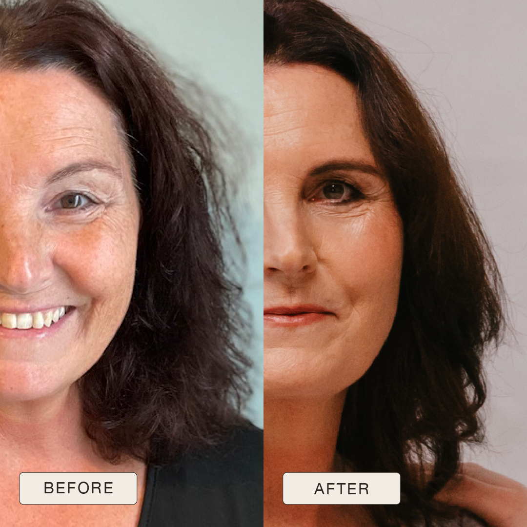 i_NaturalMagic_Before_After_Barbara_2025-14