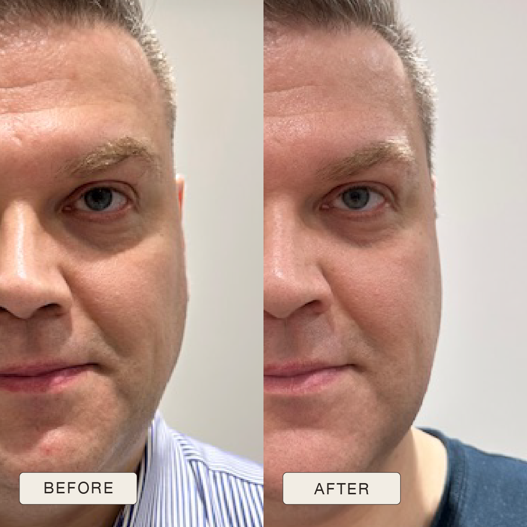 i_NaturalMagic_Before_After_Eugenijus_2025_copy
