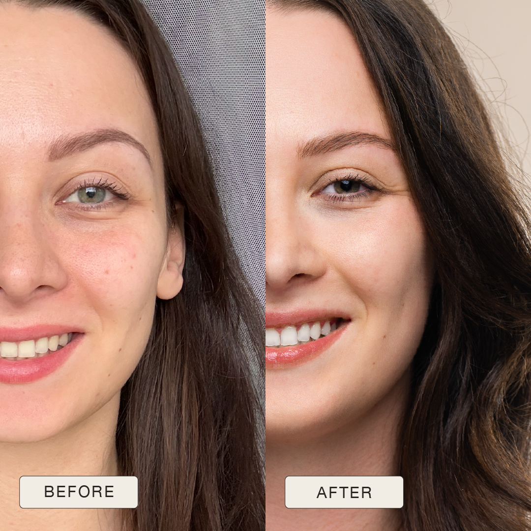 i_NaturalMagic_Before_After_Karolina_2025-12