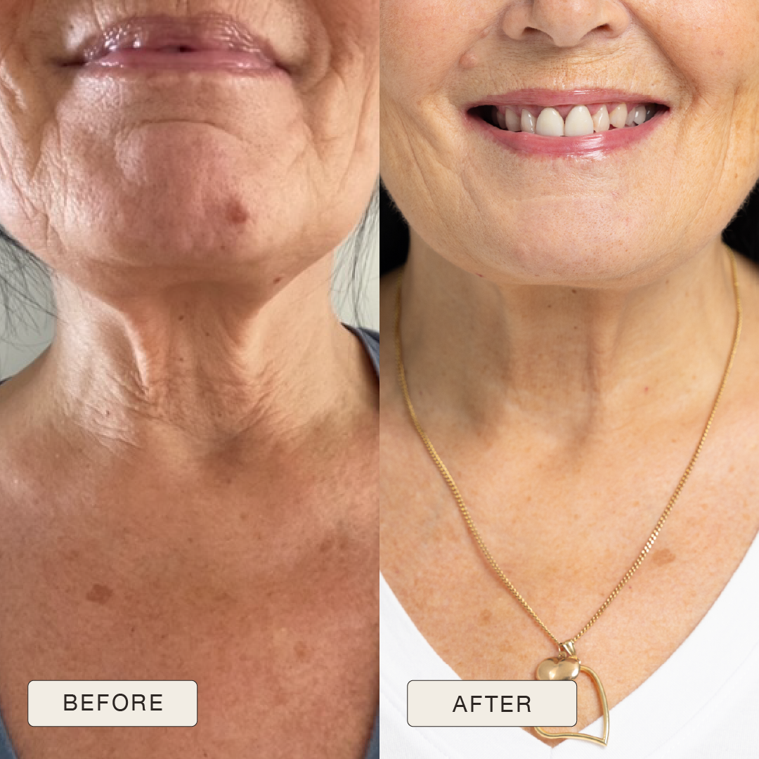 i_NaturalMagic_Before_After_P_ivi_2025-11