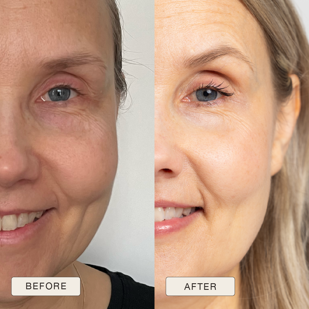 i_NaturalMagic_Before_After_Teija_FI_2025
